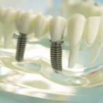 fastandfixedalternativasuperioara