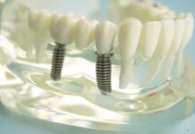 fastandfixedalternativasuperioara